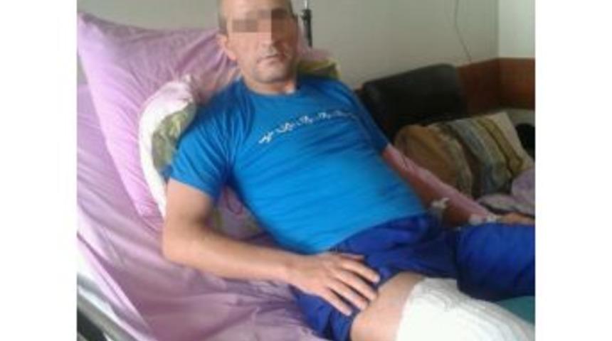 Avlanma Merakı Ayağından Etti