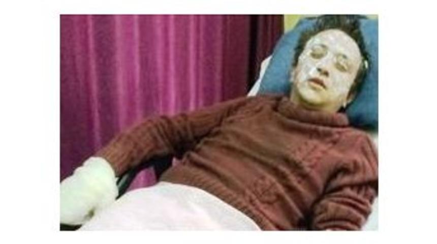 Sobayı Tutuşturmak İsterken Yandı