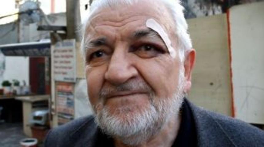 (&ouml;zel Haber) Şehrin Ortasında Pitbull Dehşeti