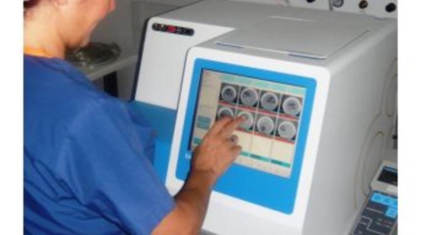 L&ouml;semili Erkekler "sperm Dondurma" Y&ouml;ntemiyle &Uuml;reyecek