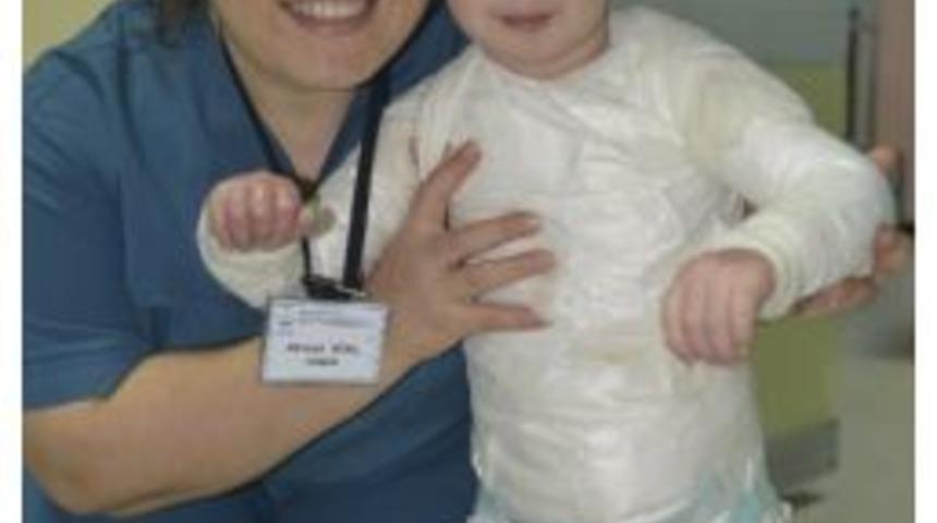 V&uuml;cudunun Y&uuml;zde 90&rsquo;ı Yanan 3 Yaşındaki Hakim İyileşti