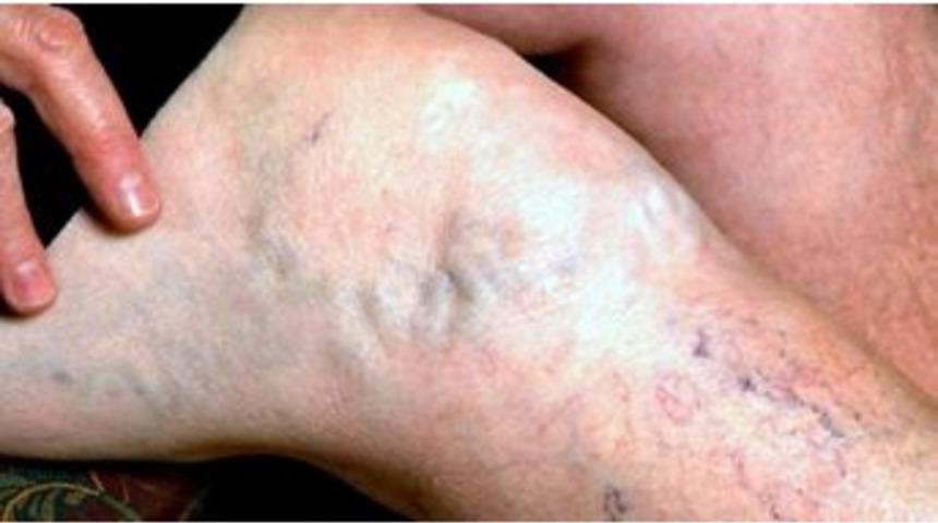 Varis Korkulu R&uuml;yanız Olmak Zorunda Değil