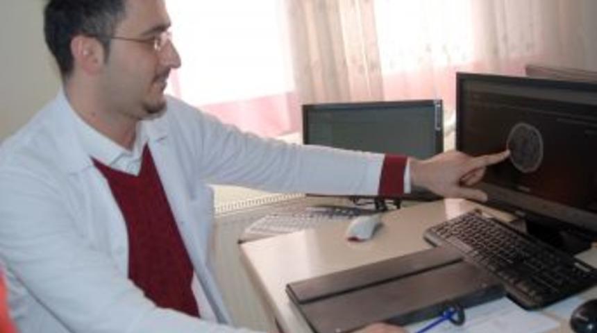 Yemeği Tatlandırma Adına Tuz Yerine Kullanılan Biber, Felce Neden Oluyor