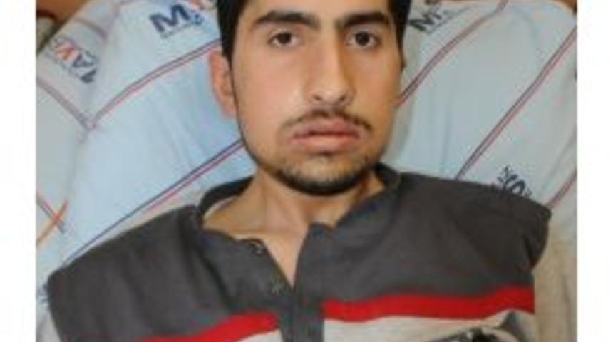 &Ccedil;ift &Ccedil;ene Ameliyatı