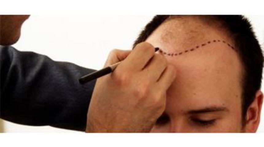 Sa&ccedil; Ekiminde Hedef Doğal G&ouml;r&uuml;n&uuml;m Olmalı