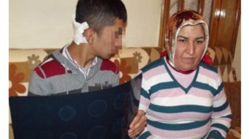 &Ouml;ğrencisini Cetvelle Yaraladı, Sonra Pişman Olup &Ouml;z&uuml;r Diledi