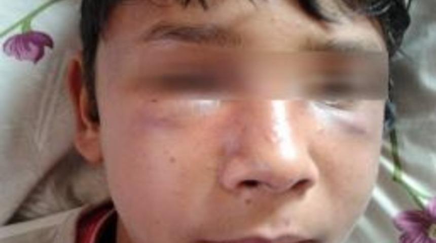 K&uuml;&ccedil;&uuml;k &Ccedil;ocuğu &Ouml;ld&uuml;resiye D&ouml;v&uuml;p Sokağa Attılar