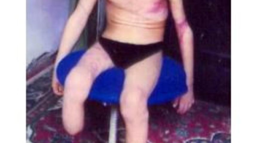 Iraklı Mustafa Muhammed&rsquo;e Engelli Aracı