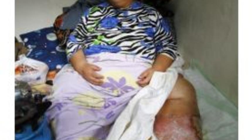 220 Kiloluk Z&ouml;hre Gezek Yardım Eli Bekliyor