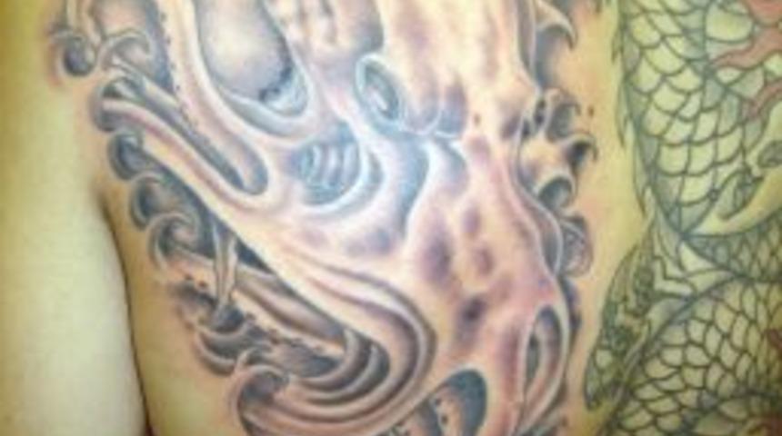 D&ouml;vme Ve Pıercıng Sarılığa Yol A&ccedil;abilir