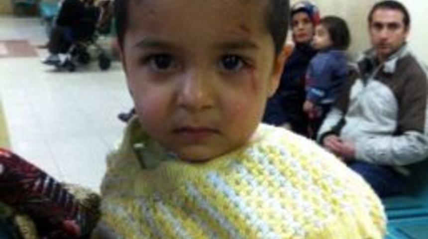2 Yaşındaki &Ccedil;ocuğun &Uuml;zerine Televizyon D&uuml;şt&uuml;
