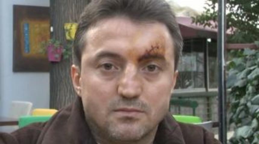 (&ouml;zel Haber) Doktordan Hasta Yakınına Darp İddiası