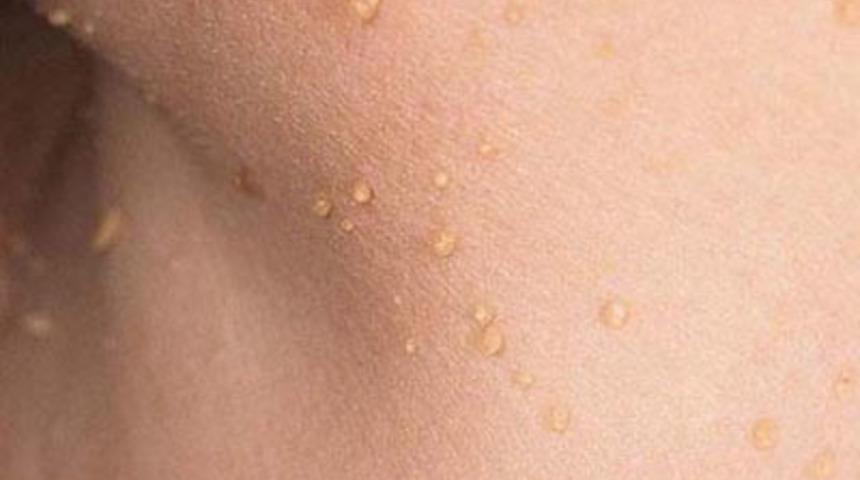 V&uuml;cutta en &ccedil;ok nefret edilen problemler