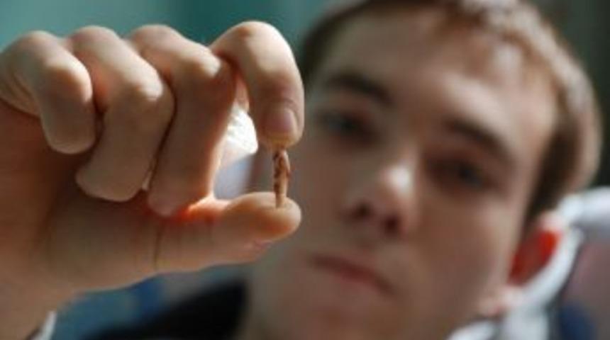 Burnundan Diş &Ccedil;ıktı