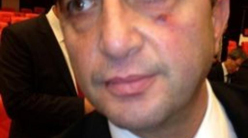 Tbmm&rsquo;de Yumruklu Kavga