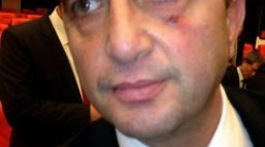 Chp&rsquo;li Tezcan, Meclis&rsquo;teki Kavgada Hastanelik Oldu