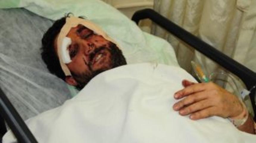 Sivas&rsquo;taki Otob&uuml;s Kazasında Yaralanan 4 Kişi, Yozgat&rsquo;ta Tedavi Altına Alındı