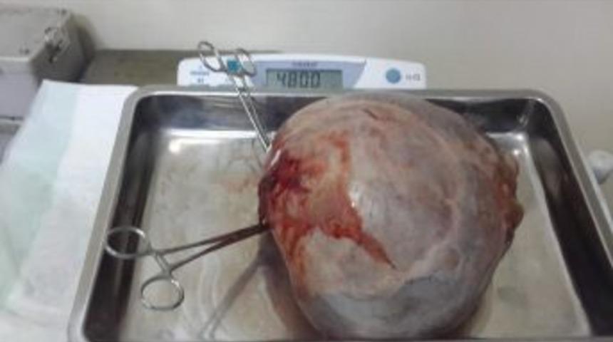 Afyonkarahisar&rsquo;da Tıp Tarihine Ge&ccedil;ecek Olay