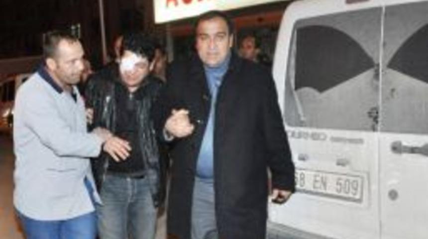 Yanıcı Sıvıyla Polisin Y&uuml;z&uuml;n&uuml; Ve G&ouml;z&uuml;n&uuml; Yaktı