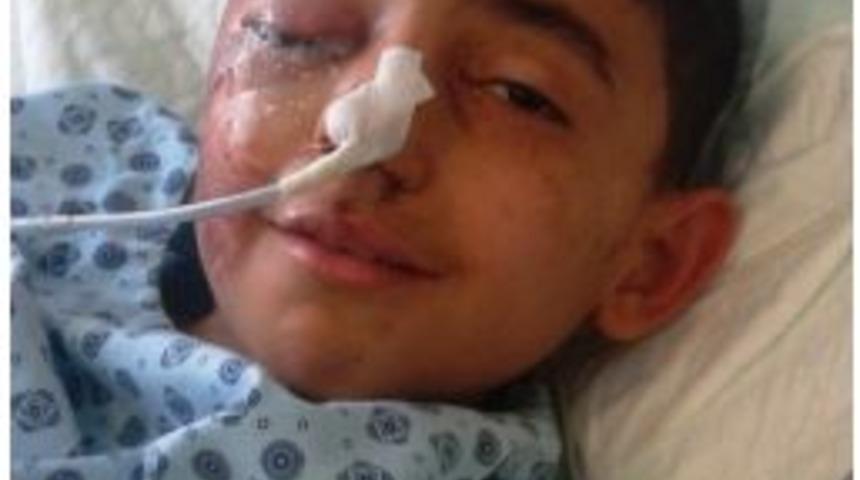 (&ouml;zel Haber) 8 Yaşındaki &Ccedil;ocuğa &Ccedil;arpıp Ka&ccedil;tı