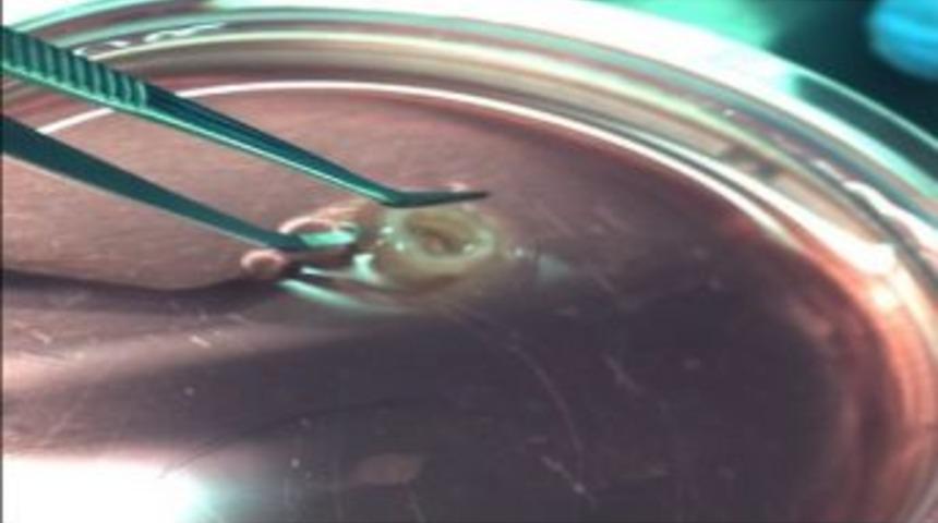 &Uuml;&ccedil; Boyutlu Yazıcı İle Canlı H&uuml;creden Aort Yapıldı