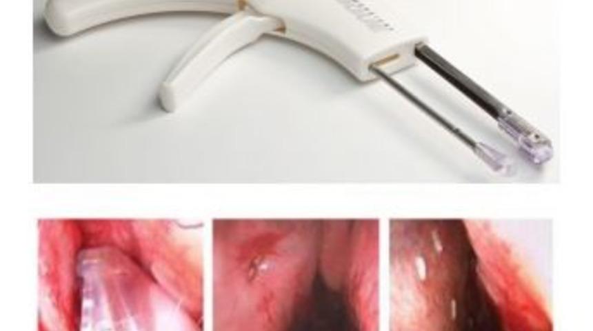 Tamponsuz Burun Ameliyatı