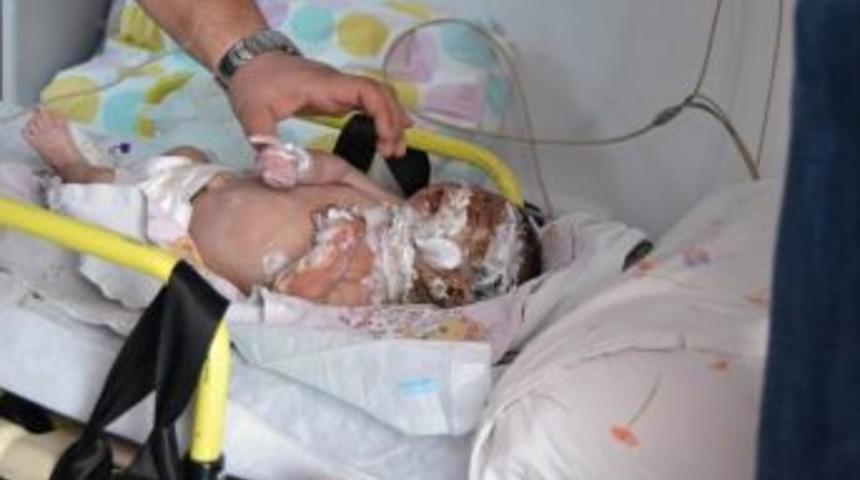 Suriyelilerin &Ccedil;adırındaki Yangında 45 G&uuml;nl&uuml;k Bebek Ağır Yaralandı