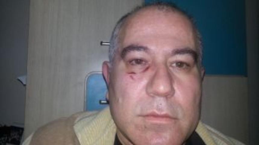 Gece Habere Giden Gazeteciyi Sokak Arasında Darp Ettiler