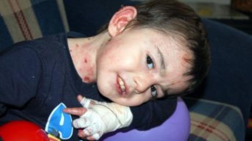 (&ouml;zel Haber) Bakan M&uuml;ezzinoğlu'ndan K&uuml;&ccedil;&uuml;k Mert&rsquo;e Yardım Eli