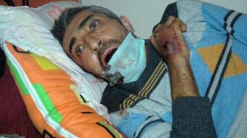 (&ouml;zel Haber) Kanser Hastası Şahsın Hayat M&uuml;cadelesi