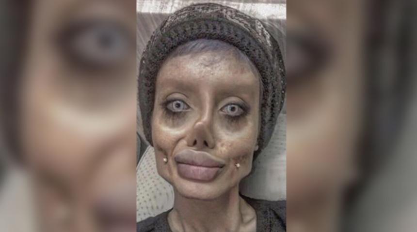 Angelina Jolie’ye benzemek istemişti! Gerçek hali böyleymiş