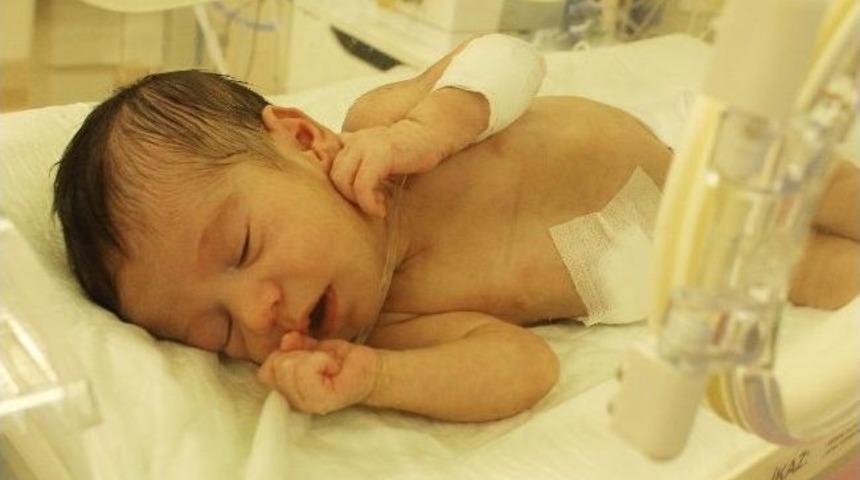 Doğduktan 3 G&uuml;n Sonra Ameliyatla Hayata Tutundular