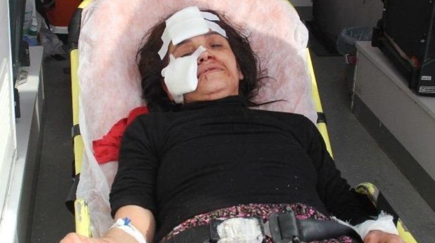 Kıskan&ccedil; Koca Eşini Bu Hale Getirdi