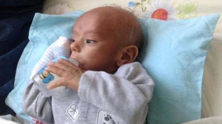 Amerika&rsquo;dan Gelen İliğin Nakledildiği Talha Bebek Yaşam Savaşını Kaybetti