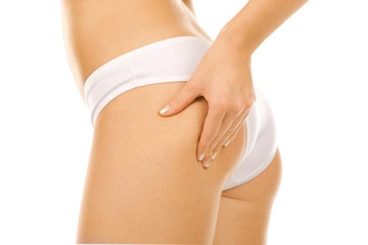 Sel&uuml;litle savaşan 6 besin