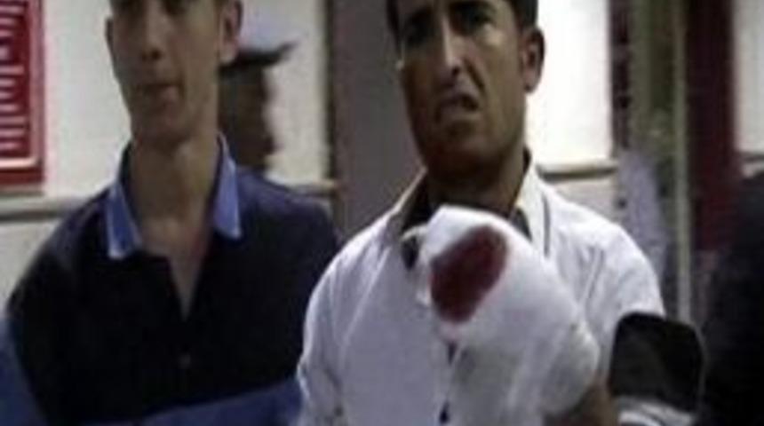 Serbest Bırakıldığı G&uuml;n Silahla Kendini Vurduğu İddiası