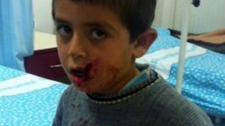 Atla Oyun Oynayayım Derken Canından Oluyordu