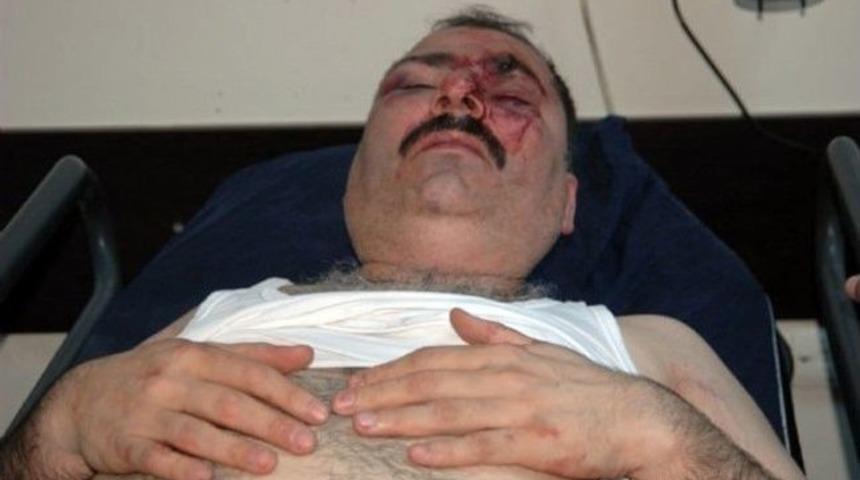 Mansur Yavaş'a 'davanı Sattın' Dedi, Komalık Oldu