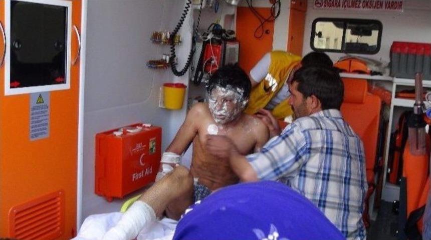 Boya Yaparken Y&uuml;ksek Gerilime Kapıldı