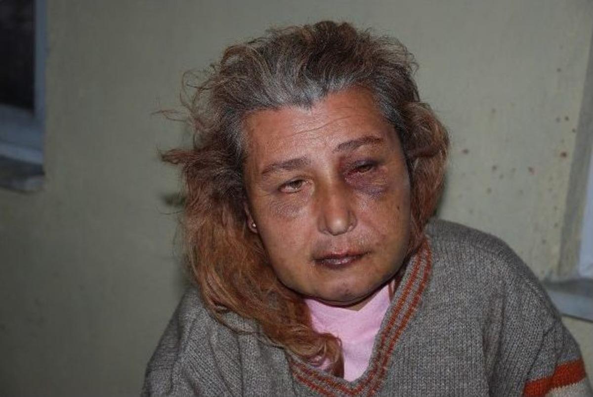 Dayak Yiyen Kadın &Ouml;l&uuml;m Korkusu Yaşıyor