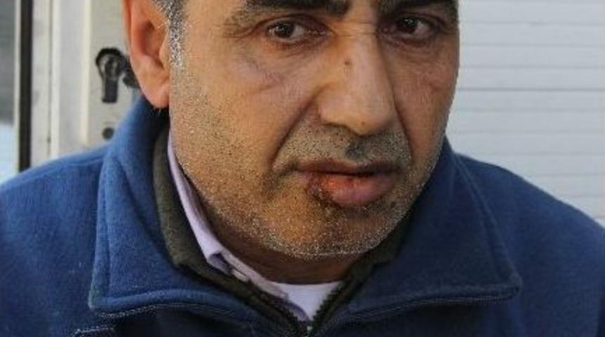 (&ouml;zel Haber) Şemsiyeyi A&ccedil;tı, Yıldırım &Ccedil;arptı