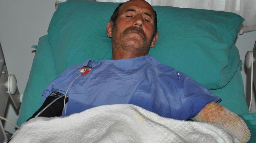 Yanık B&ouml;lge Deri Nakliyle Kapatıldı