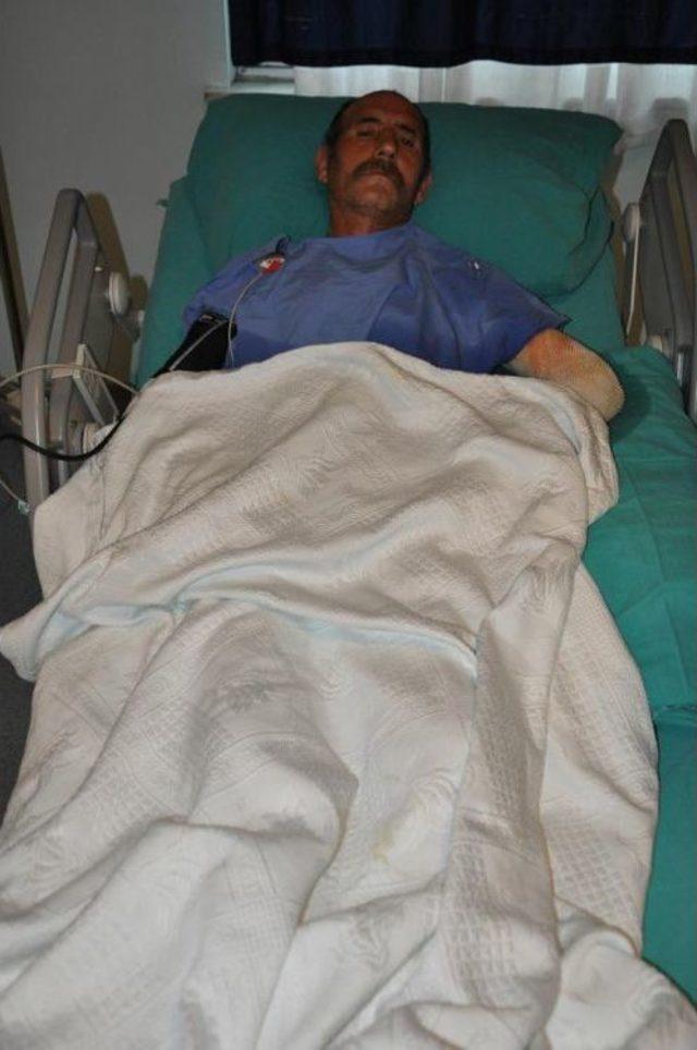 Yanık Bölge Deri Nakliyle Kapatıldı 2