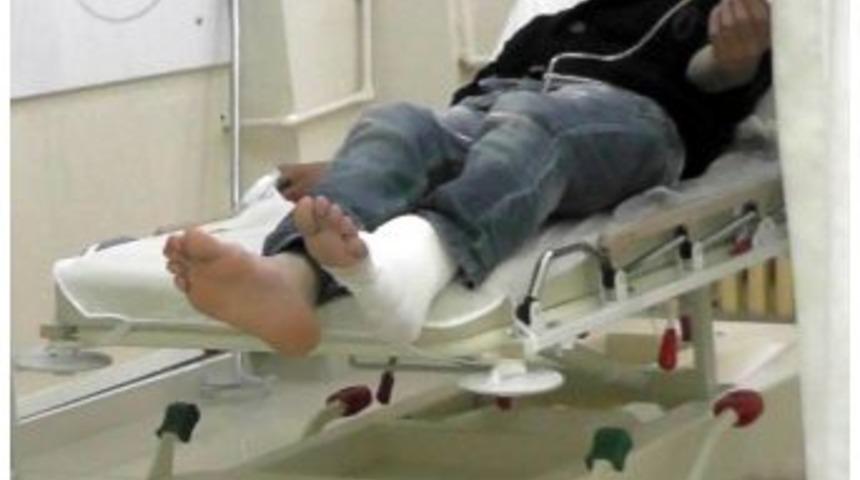 Odun Yerine Ayağını Kesti