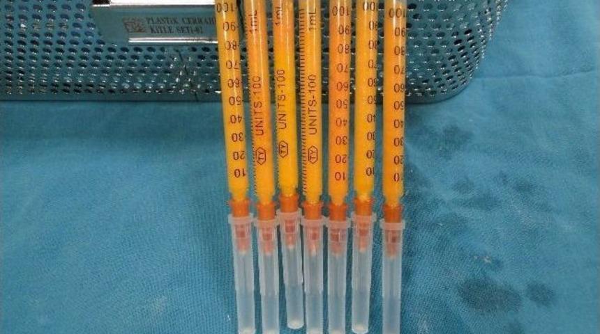 Yağ Enjeksiyonu İle G&uuml;zelleşmek M&uuml;mk&uuml;n