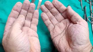 Ameliyat sonrası ellerini paylaşan doktor sosyal medyayı salladı