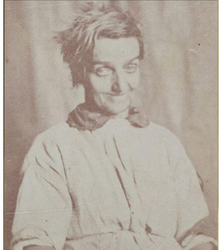 1800'lerin akıl hastanesinden tüyler ürperten fotoğraflar G4