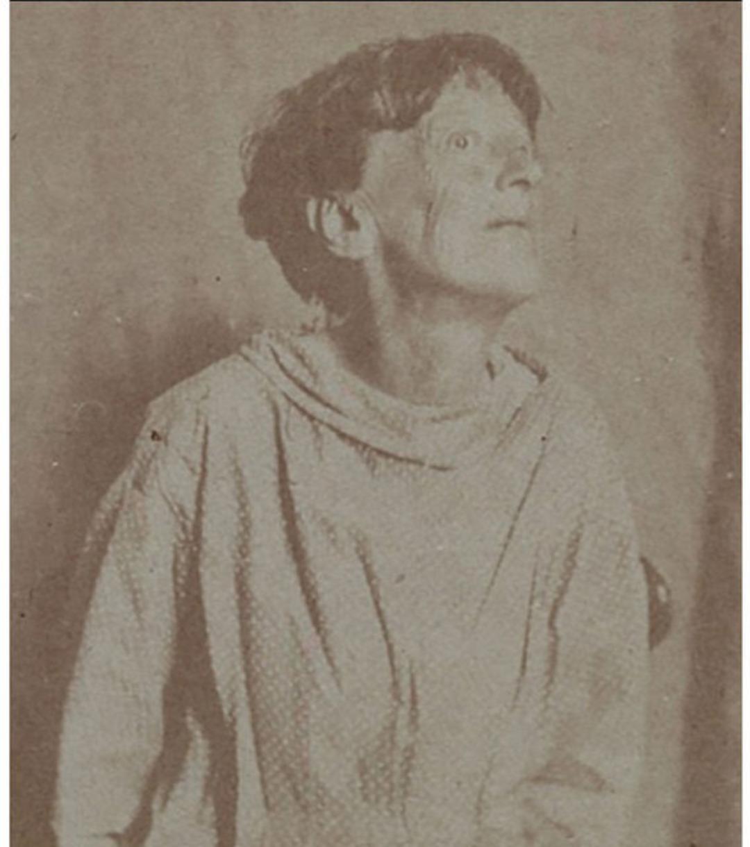 1800'lerin akıl hastanesinden t&uuml;yler &uuml;rperten fotoğraflar