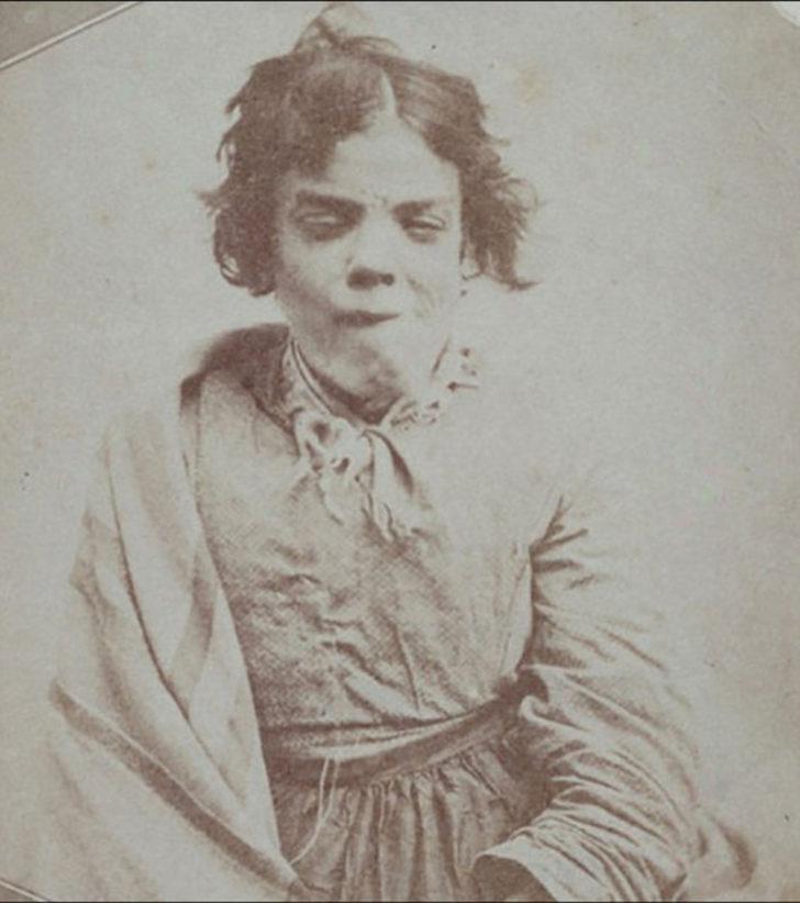 1800'lerin akıl hastanesinden tüyler ürperten fotoğraflar G1