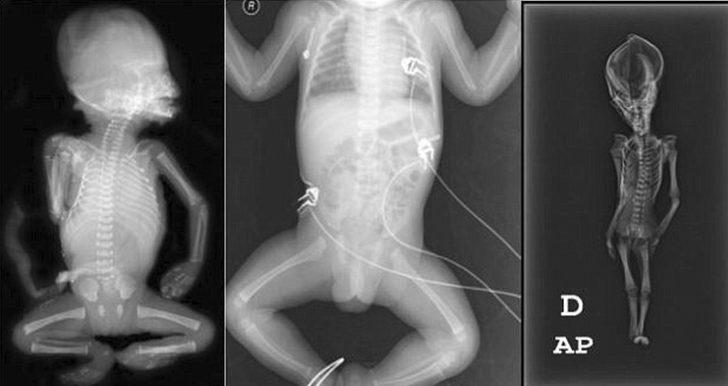 Uzaylı olduğu iddia edilen mumyanın sırrı çözüldü G4